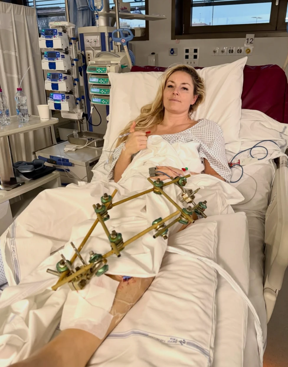 Lindsey Vonn’s Brutal Olympic Leg Injury, Explained By a Doctor
