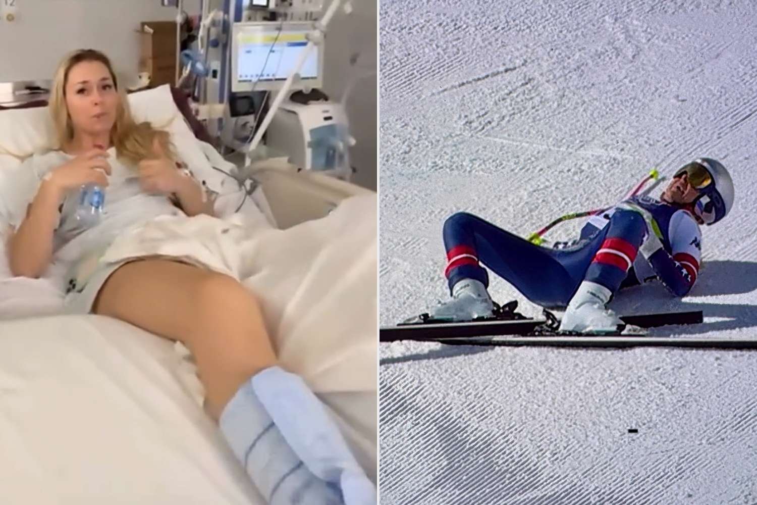 Lindsey Vonn Says She’s Been ‘Struggling’ After Multiple Leg Surgeries